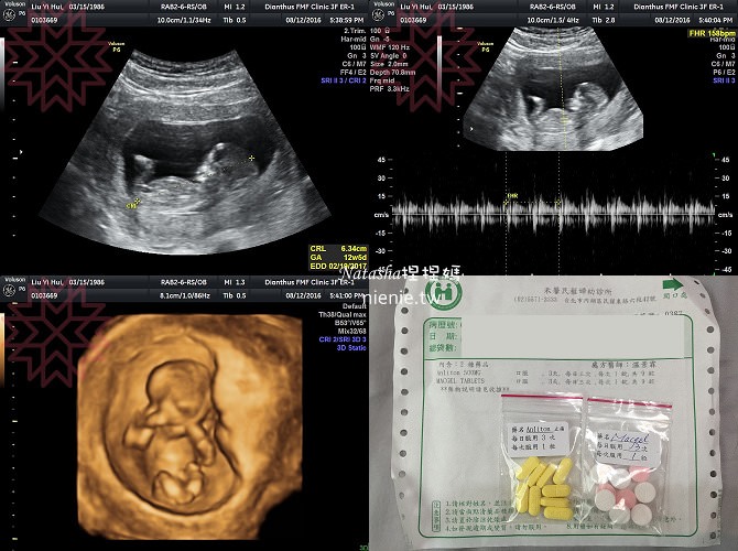 懷孕紀錄│初期0個月~4個月│初唐、子癲前症、早產風險評估~妊娠劇吐症14
